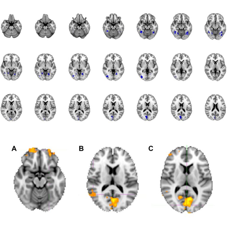 2 Faces of Writing: Structure or Talent? Montecristo Project - Article on Human Neuroscience
